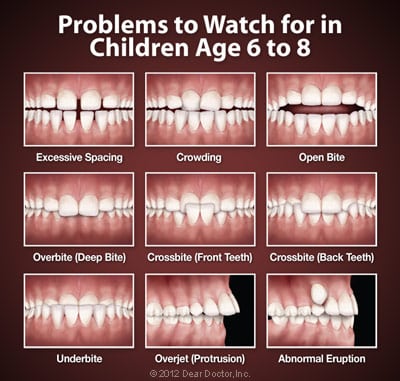 image of orthodontic problems