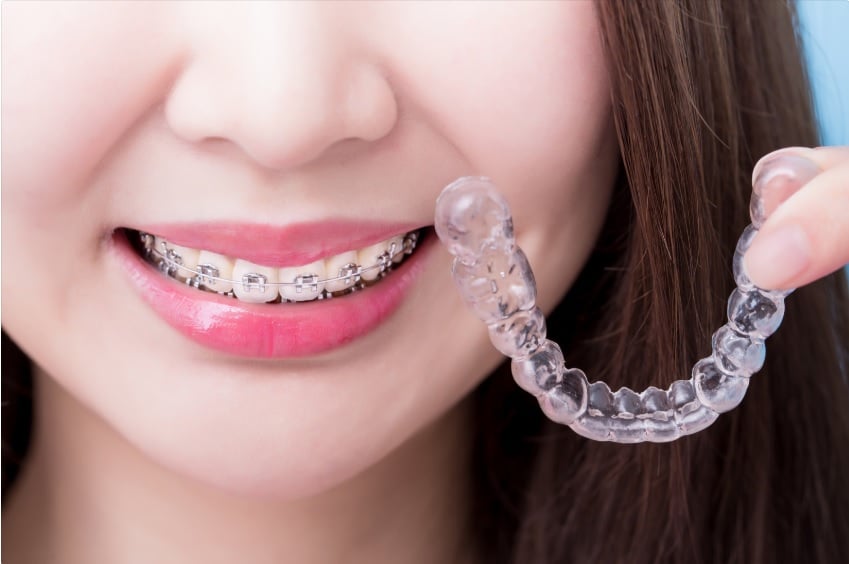 Which is better Invisalign or braces?