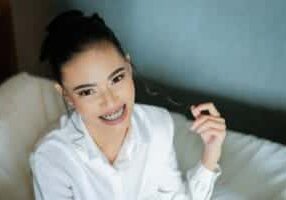 woman with braces in white shirt